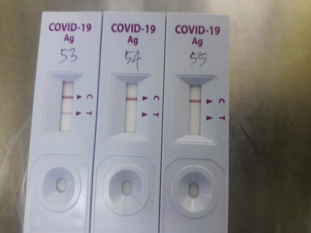 การทดสอบ PCR กับแอนติเจน: การทดสอบ COVID-19 ใดที่เหมาะกับฉัน?